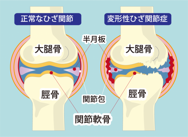 膝関節の画像